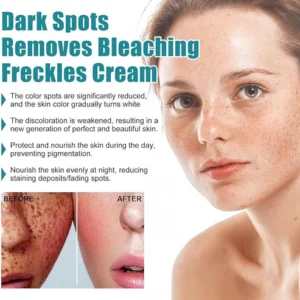 Eelhoe - Dark Spots Removes Cream (Original)